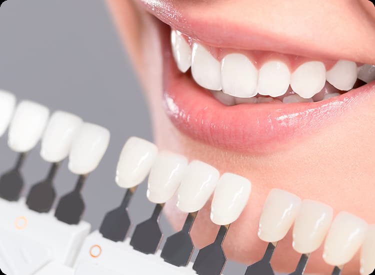 Reinvente Seu Sorriso com Lentes de Contato